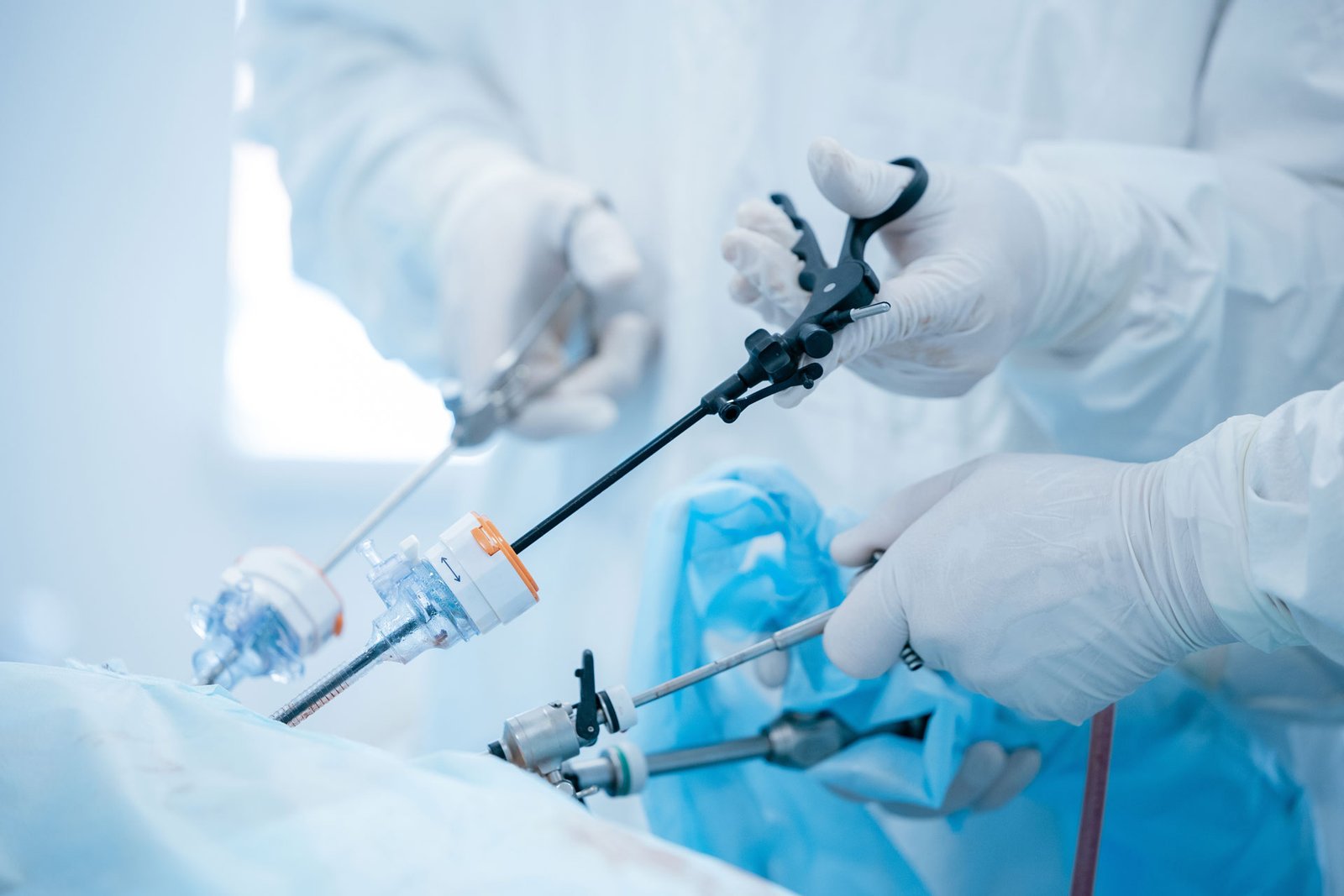 Tecnología Laparoscópica