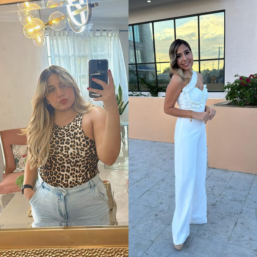 Paciente feliz después de su transformación